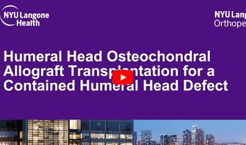 Humeral Head Osteochondral Allograft Transplantation - Video Thumbnail