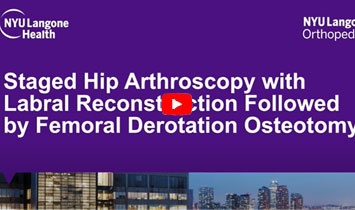 Staged Hip Arthroscopy - Video Thumbnail